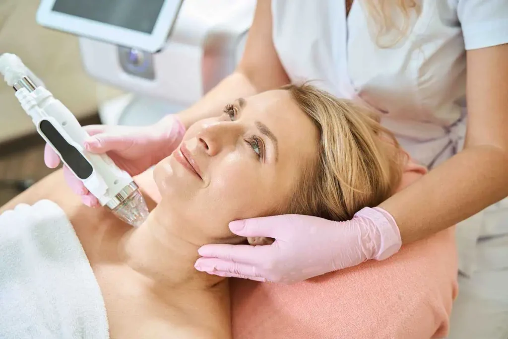 Microneedling at Smooch Aesthetics in Murrysville, PA