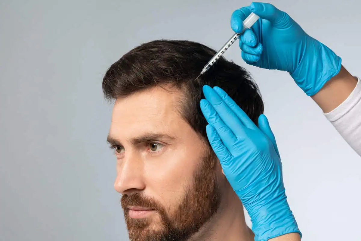 Hair Restoration by smoochaesthetics in Murrysville, PA