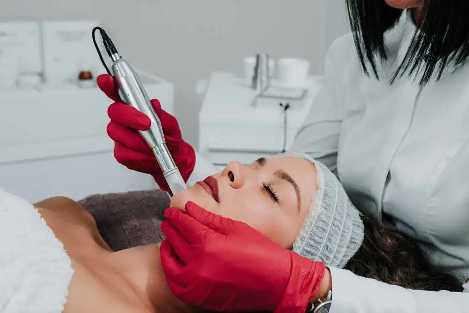 Microneedling Treatment in Murrysville, PA by Smooch Aesthetics