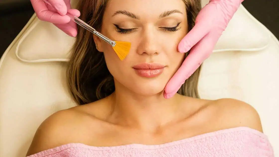 Chemical Peels in Murrysville, PA by Smooch Aesthetics