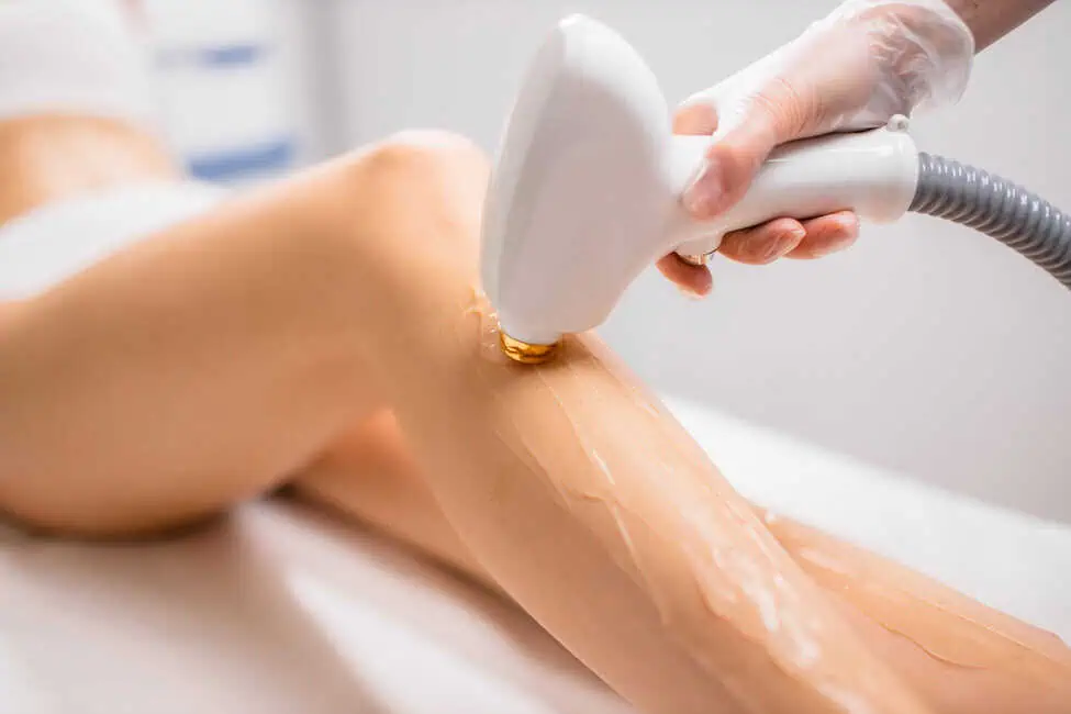 Laser Hair Removal by smoochaesthetics in Murrysville, PA