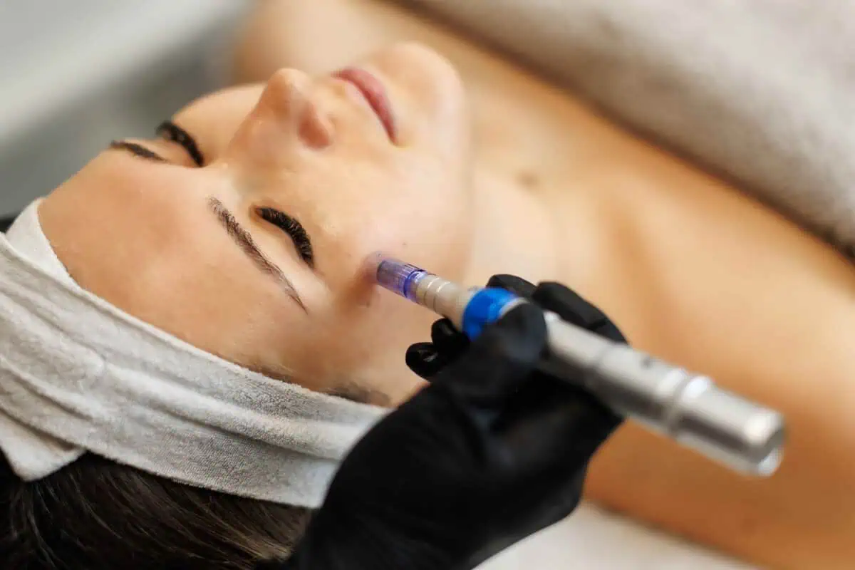 Facial Rejuvenation Without Surgery at Smooch Aesthetics